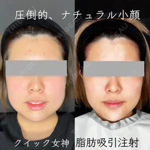 Wing clinic 豊中駅前院 速水 翼医師の症例