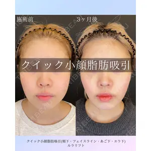 ルラ美容クリニック 札幌院 佐藤 雄紀医師の症例