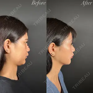 R Beauty CLINIC 名古屋院 木村 尚大医師の症例