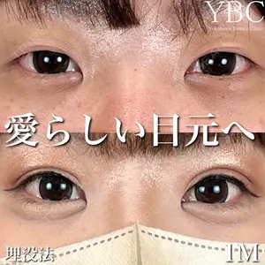 YBC横浜美容外科 大宮院 磯村 亮輔医師の症例