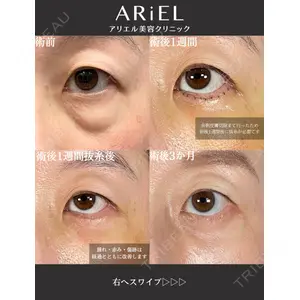 アリエル美容クリニック 大宮院 鈴木　桂介医師の症例