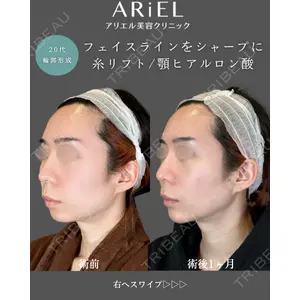 アリエル美容クリニック 郡山院 安齋 誠基医師の症例
