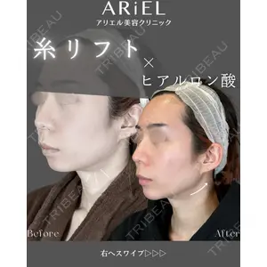 アリエル美容クリニック 郡山院 安齋 誠基医師の症例