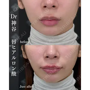 EMMO FACE CLINIC 大阪梅田院 神谷 一成医師の症例