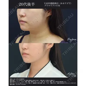 湘南美容クリニック 名古屋院 山本 高士医師の症例