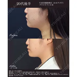 湘南美容クリニック 名古屋院 山本 高士医師の症例