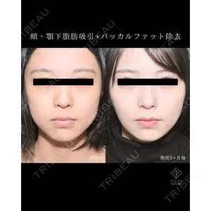 藤・ナチュレ美容クリニック 銀座院 小川 杏平医師の症例