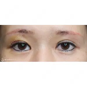 聖心美容クリニック 福岡院 西田 真医師の症例