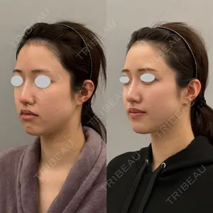 ARIEL.BUST.CLINIC 石塚 紀行医師の症例