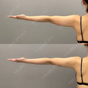 ARIEL.BUST.CLINIC 石塚 紀行医師の症例