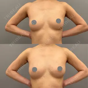 ARIEL.BUST.CLINIC 石塚 紀行医師の症例