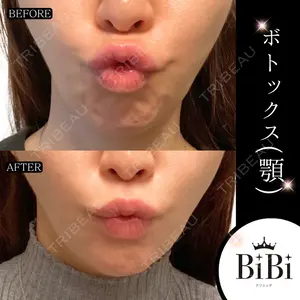 BiBiクリニック 山本 幸一郎医師の症例