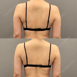 ARIEL.BUST.CLINIC 石塚 紀行医師の症例