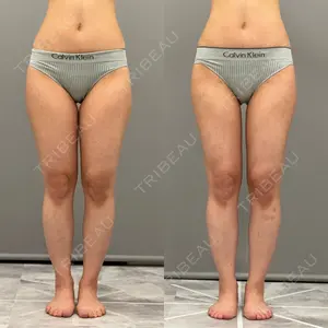 ARIEL.BUST.CLINIC 石塚 紀行医師の症例