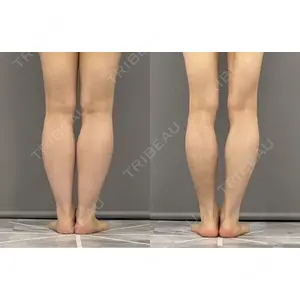 ARIEL.BUST.CLINIC 石塚 紀行医師の症例