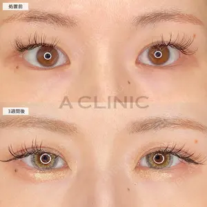 A CLINIC（エークリニック） 池袋院 三橋 克之医師の症例
