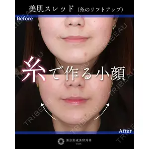 東京形成美容外科 船橋院 山崎 修吾医師の症例