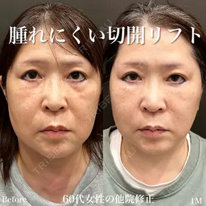 YBC横浜美容外科 大宮院 磯村 亮輔医師の症例