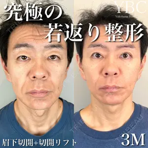 YBC横浜美容外科 大宮院 磯村 亮輔医師の症例