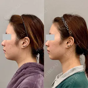ARIEL.BUST.CLINIC 石塚 紀行医師の症例