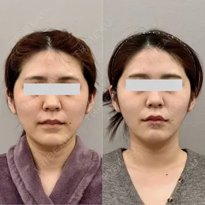 ARIEL.BUST.CLINIC 石塚 紀行医師の症例