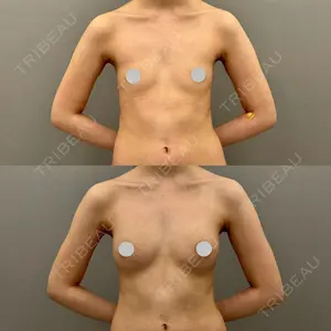 ARIEL.BUST.CLINIC 石塚 紀行医師の症例