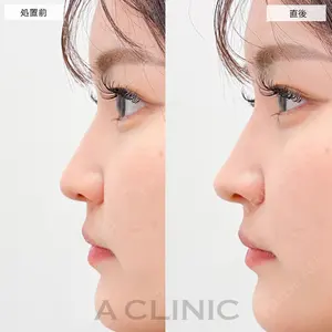 A CLINIC（エークリニック） 大阪院 田窪 賢志郎医師の症例