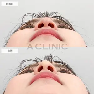 A CLINIC（エークリニック） 大阪院 田窪 賢志郎医師の症例