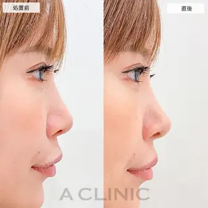 A CLINIC（エークリニック） 大阪院 田窪 賢志郎医師の症例