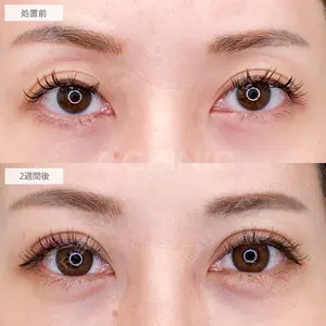A CLINIC（エークリニック） 大阪院 木家 佑理子医師の症例