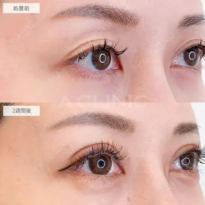 A CLINIC（エークリニック） 大阪院 木家 佑理子医師の症例