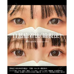 シンデレラ＆ダヴィンチクリニック 宮田 洋佑医師の症例