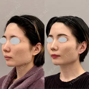 ARIEL.BUST.CLINIC 石塚 紀行医師の症例