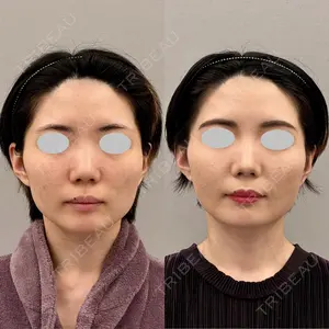 ARIEL.BUST.CLINIC 石塚 紀行医師の症例