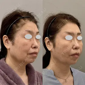 ARIEL.BUST.CLINIC 石塚 紀行医師の症例
