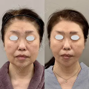 ARIEL.BUST.CLINIC 石塚 紀行医師の症例