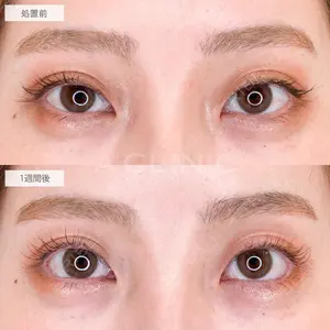 A CLINIC（エークリニック） 大阪院 木家 佑理子医師の症例