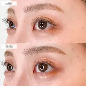 A CLINIC（エークリニック） 大阪院 木家 佑理子医師の症例