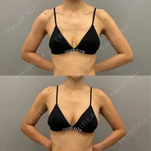 ARIEL.BUST.CLINIC 石塚 紀行医師の症例