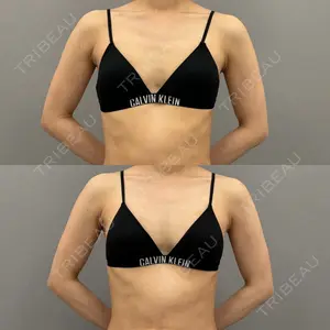 ARIEL.BUST.CLINIC 石塚 紀行医師の症例