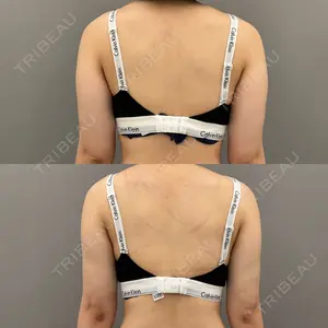 ARIEL.BUST.CLINIC 石塚 紀行医師の症例