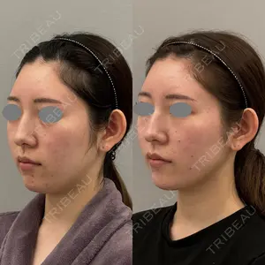 ARIEL.BUST.CLINIC 石塚 紀行医師の症例