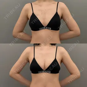ARIEL.BUST.CLINIC 石塚 紀行医師の症例