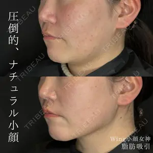 Wing clinic 豊中駅前院 速水 翼医師の症例