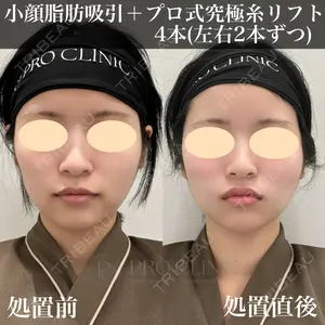 PRO CLINIC プロクリニック 銀座院 洪 嵩典医師の症例