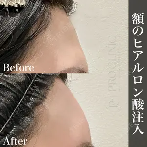 PRO CLINIC プロクリニック 銀座院 洪 嵩典医師の症例