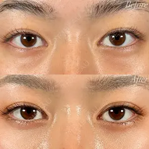 R Beauty CLINIC 名古屋院 木村 尚大医師の症例