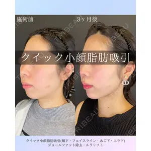 ルラ美容クリニック 札幌院 佐藤 雄紀医師の症例