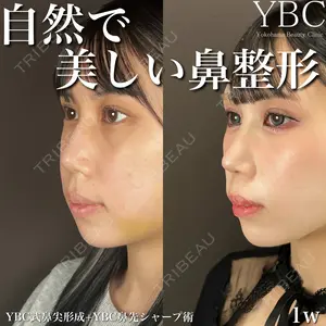 YBC横浜美容外科 大宮院 磯村 亮輔医師の症例