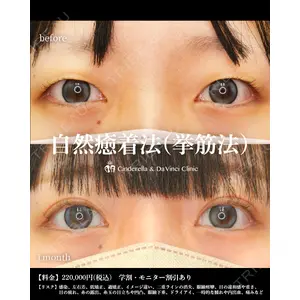 シンデレラ＆ダヴィンチクリニック 宮田 洋佑医師の症例